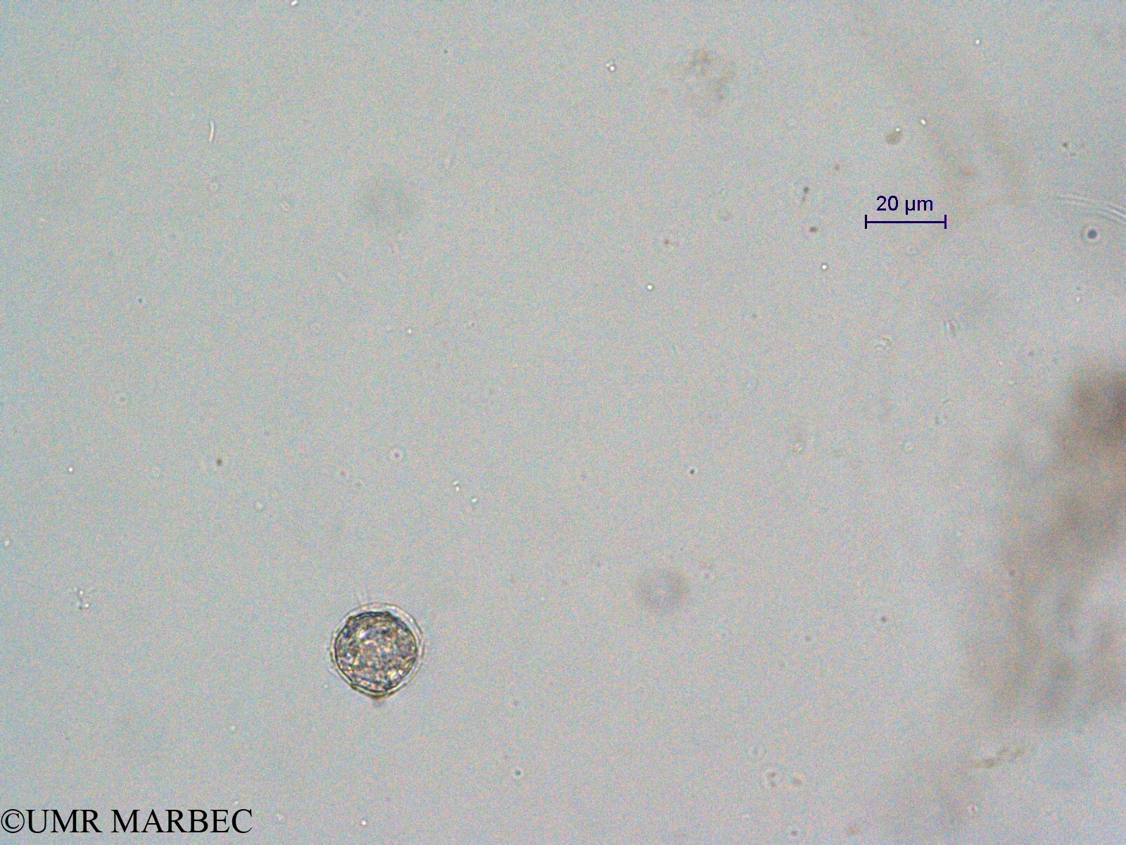 phyto/Scattered_Islands/all/COMMA April 2011/Protoperidinium steinii (ancien Protoperidinium sp21-1)(copy).jpg